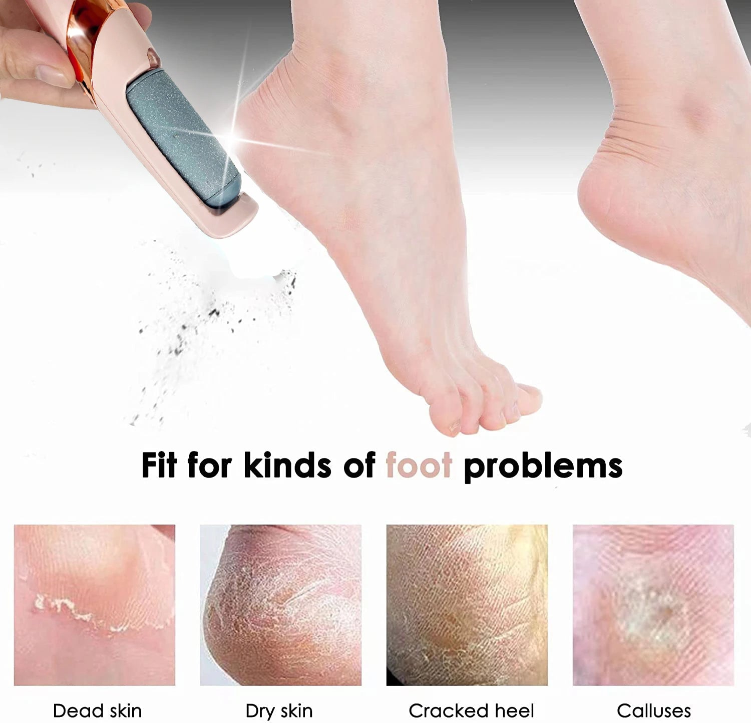 PediPerfection™ - Cordless Electric Callus Remover | + FREE TOOLS
