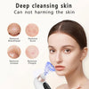 HydroVac™ – Blackhead Remover with Water Cycle Cleaning