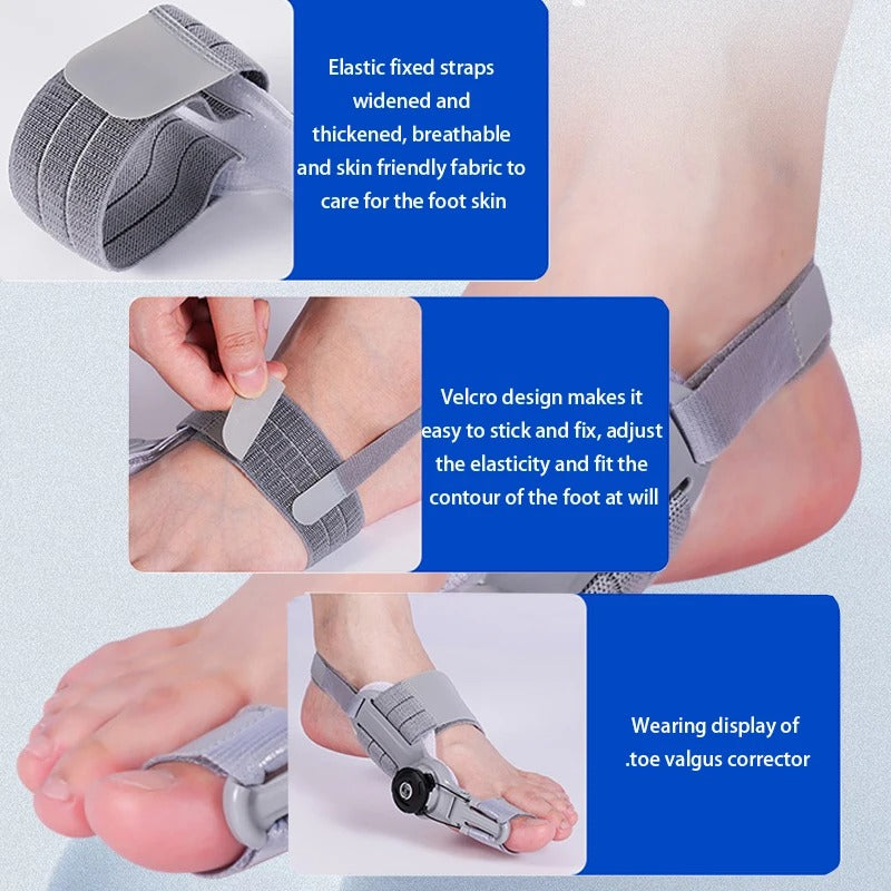 BUY 1 GET 2 | AlignToe™ – Adjustable Bunion Corrector