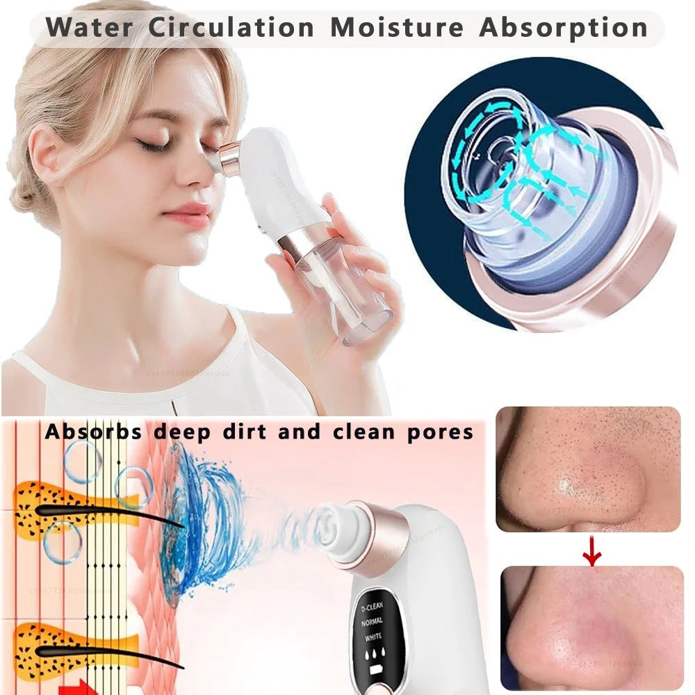 HydroVac™ – Blackhead Remover with Water Cycle Cleaning