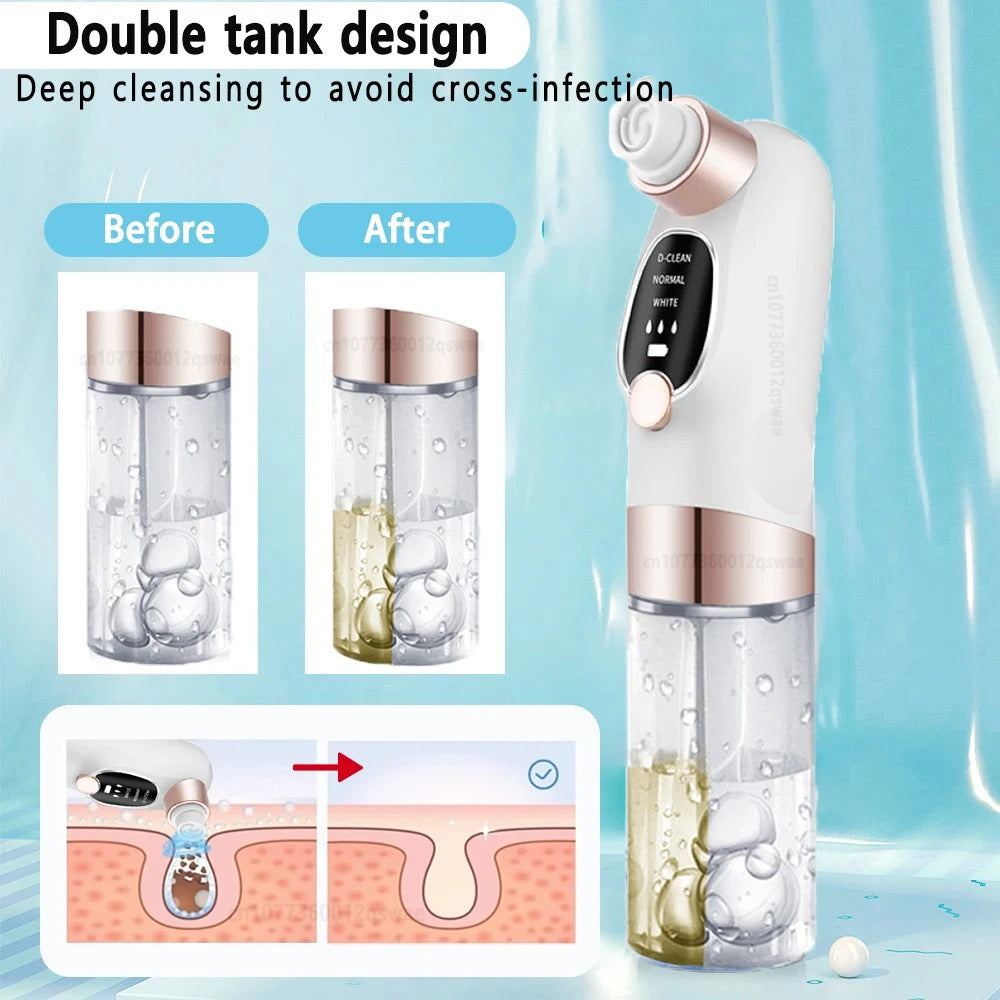 HydroVac™ – Blackhead Remover with Water Cycle Cleaning