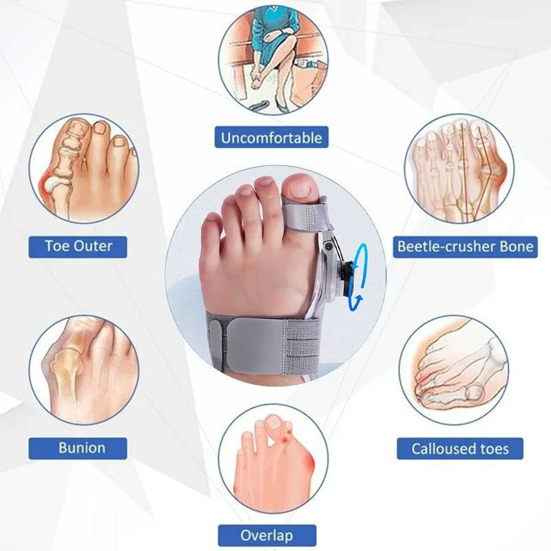 BUY 1 GET 2 | AlignToe™ – Adjustable Bunion Corrector