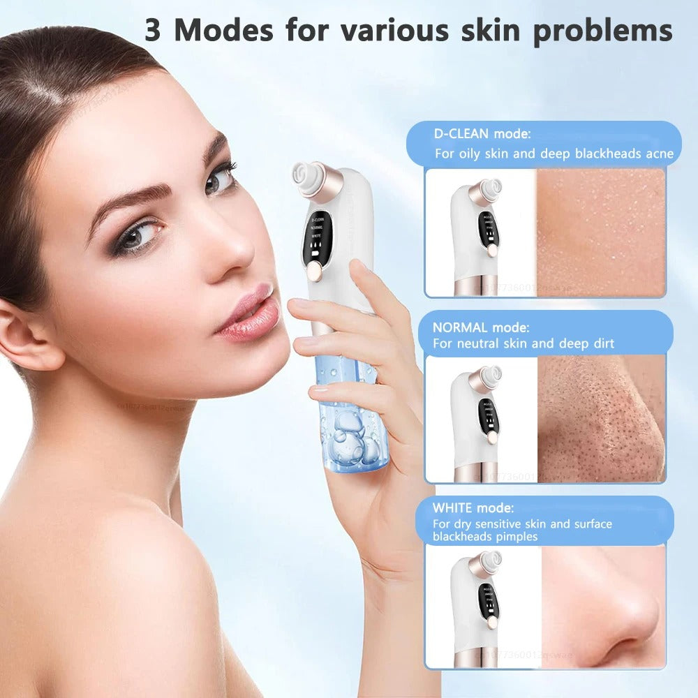 HydroVac™ – Blackhead Remover with Water Cycle Cleaning