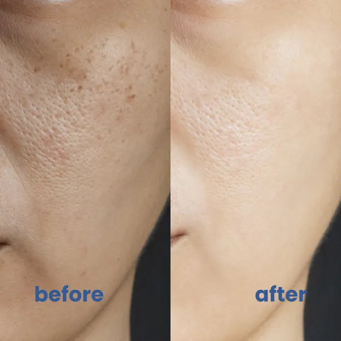 GlowTone™ - Flawless Skin for Every Face!