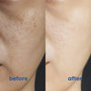 GlowTone™ - Flawless Skin for Every Face!